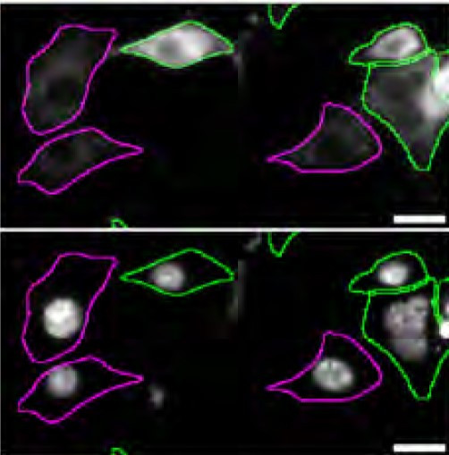 RAB27B Antibody in Immunocytochemistry (ICC/IF)