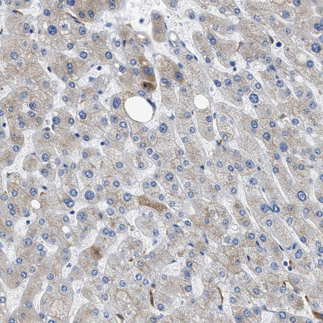 GC Antibody in Immunohistochemistry (Paraffin) (IHC (P))