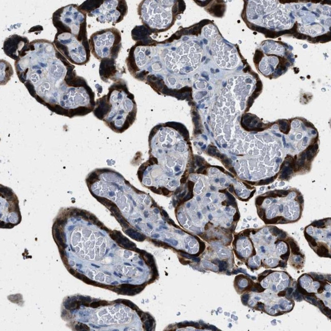 PHRF1 Antibody in Immunohistochemistry (Paraffin) (IHC (P))