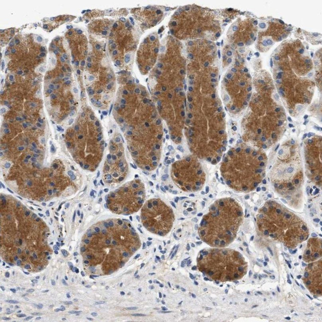PPM1L Antibody in Immunohistochemistry (IHC)