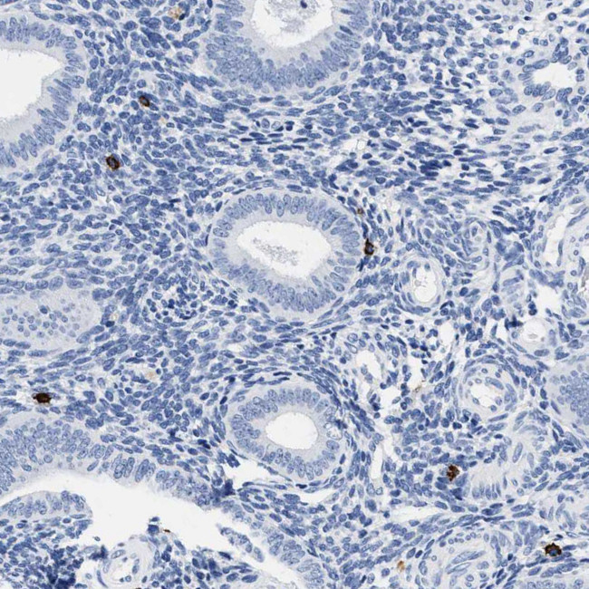 CER1 Antibody in Immunohistochemistry (Paraffin) (IHC (P))