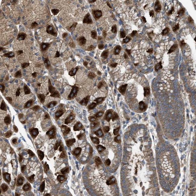 PDP2 Antibody in Immunohistochemistry (Paraffin) (IHC (P))