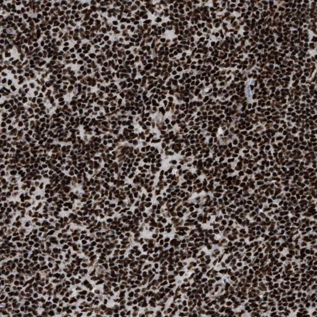 LUC7L3 Antibody in Immunohistochemistry (Paraffin) (IHC (P))