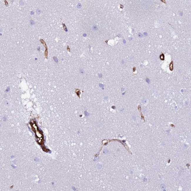 NXPH1 Antibody in Immunohistochemistry (Paraffin) (IHC (P))