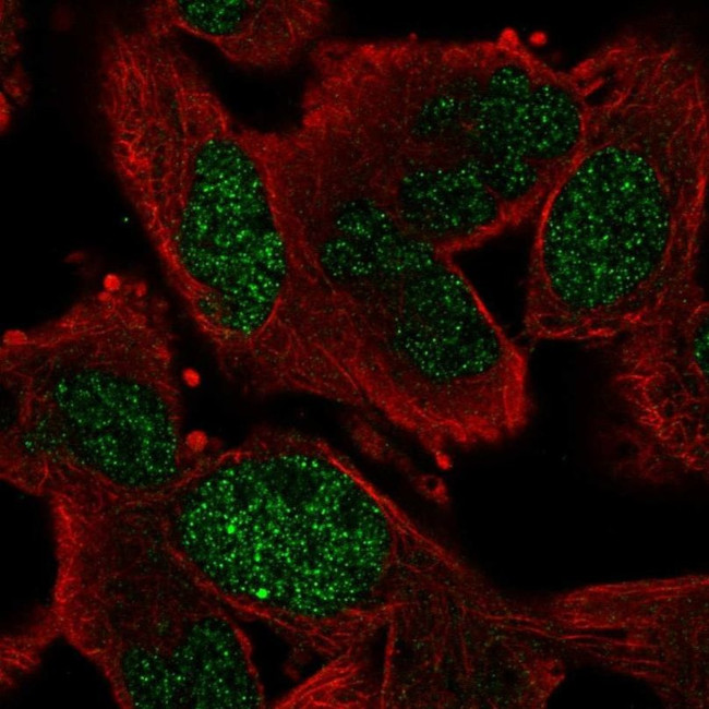 GEN1 Antibody in Immunocytochemistry (ICC/IF)