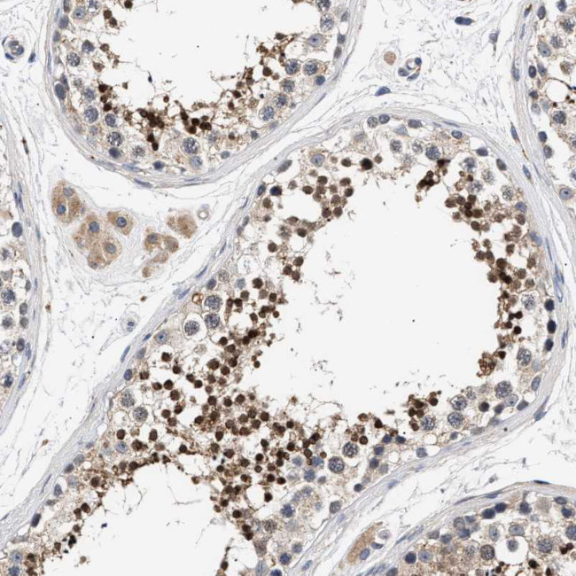 CCDC146 Antibody in Immunohistochemistry (Paraffin) (IHC (P))