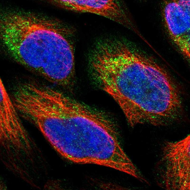 PNPLA8 Antibody in Immunocytochemistry (ICC/IF)