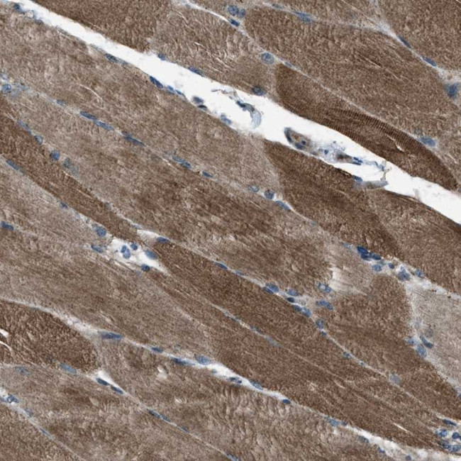 SVIL Antibody in Immunohistochemistry (Paraffin) (IHC (P))