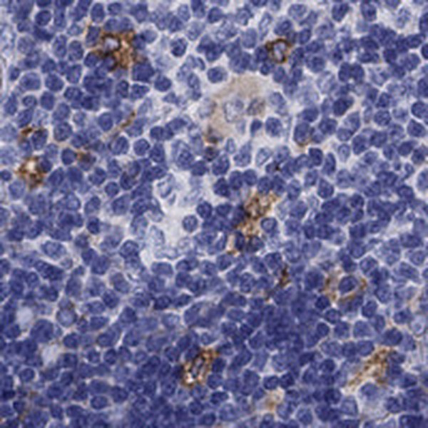 TSCOT Antibody in Immunohistochemistry (IHC)