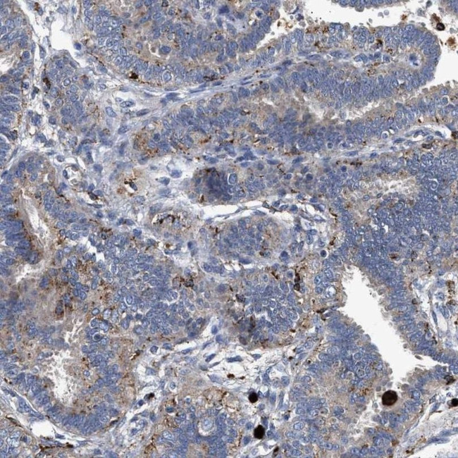 CCDC146 Antibody in Immunohistochemistry (IHC)