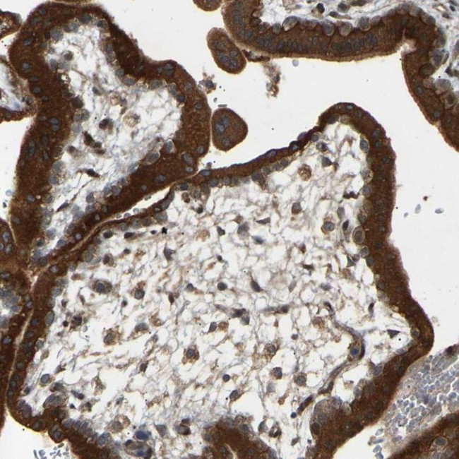 PTCD1 Antibody in Immunohistochemistry (IHC)