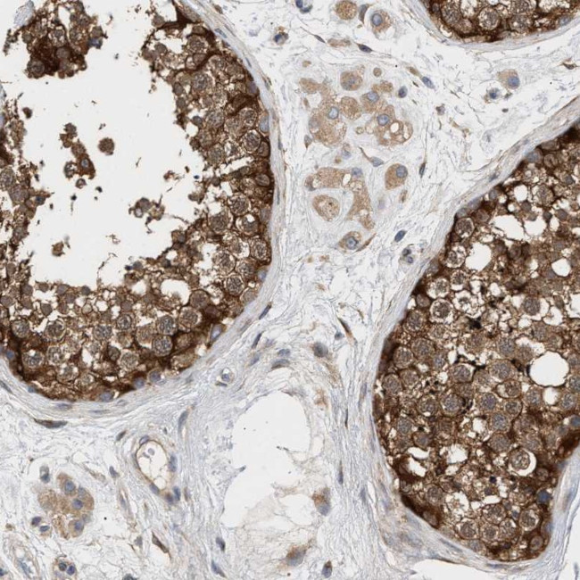 PLCD1 Antibody in Immunohistochemistry (Paraffin) (IHC (P))
