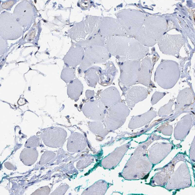 AHNAK2 Antibody in Immunohistochemistry (Paraffin) (IHC (P))