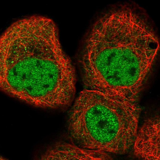 KLHDC10 Antibody in Immunocytochemistry (ICC/IF)