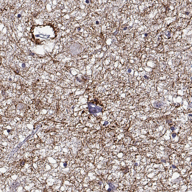 DDX25 Antibody in Immunohistochemistry (IHC)
