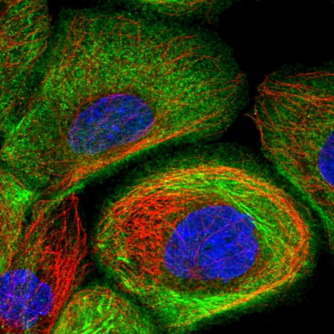 SVIL Antibody in Immunocytochemistry (ICC/IF)