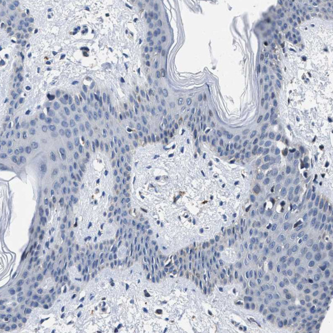 CaV1.3 Antibody in Immunohistochemistry (Paraffin) (IHC (P))