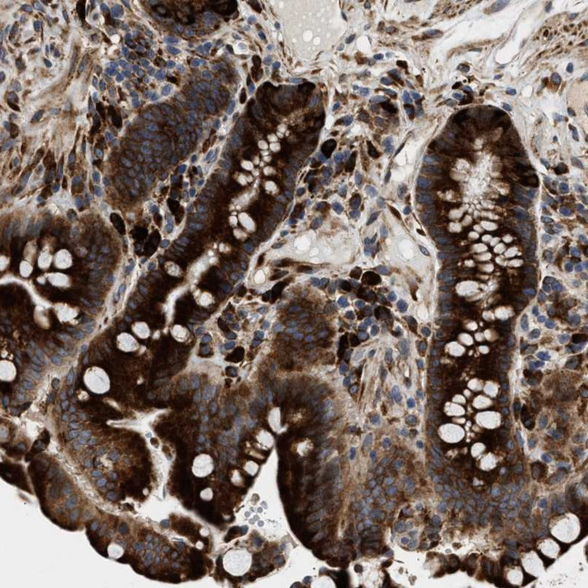 AMZ1 Antibody in Immunohistochemistry (Paraffin) (IHC (P))