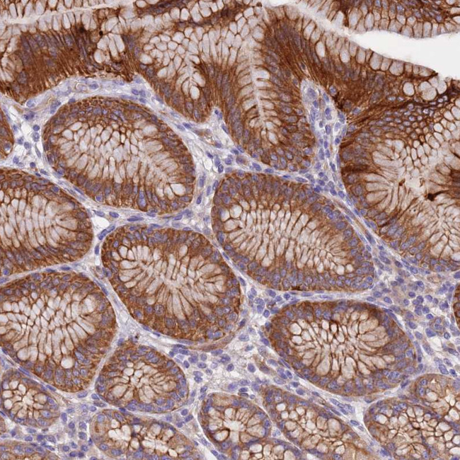 Laminin beta-4 Antibody in Immunohistochemistry (Paraffin) (IHC (P))