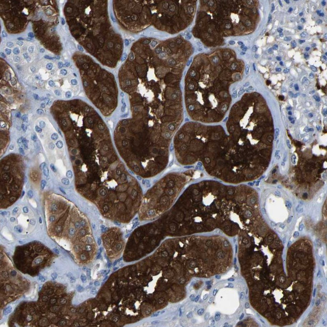 HEATR2 Antibody in Immunohistochemistry (Paraffin) (IHC (P))