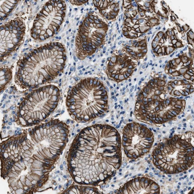 MUPP1 Antibody in Immunohistochemistry (Paraffin) (IHC (P))