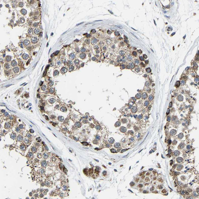 GIMA7 Antibody in Immunohistochemistry (Paraffin) (IHC (P))