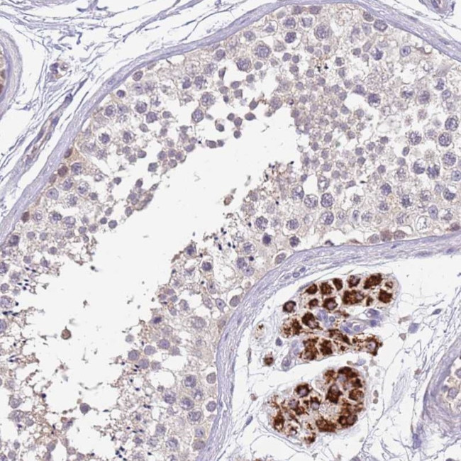 ZNF746 Antibody in Immunohistochemistry (Paraffin) (IHC (P))