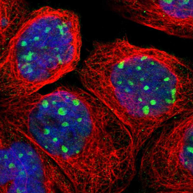 RRP1B Antibody in Immunocytochemistry (ICC/IF)
