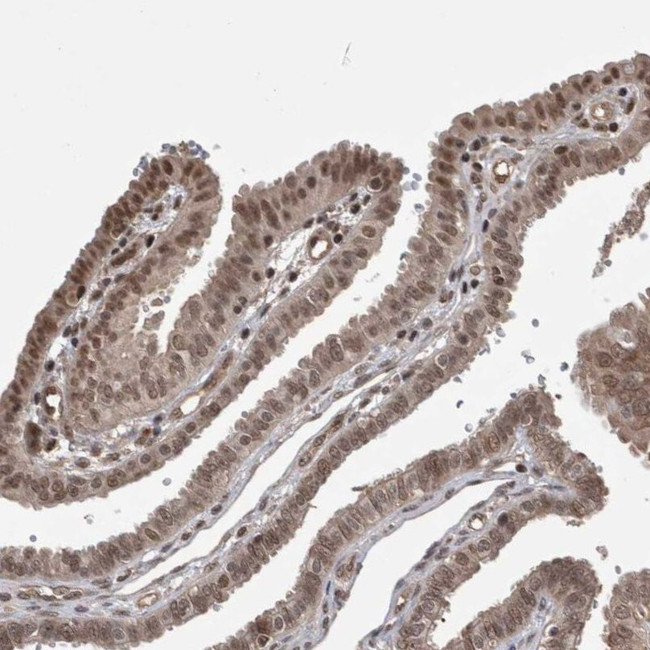 ZNF592 Antibody in Immunohistochemistry (IHC)