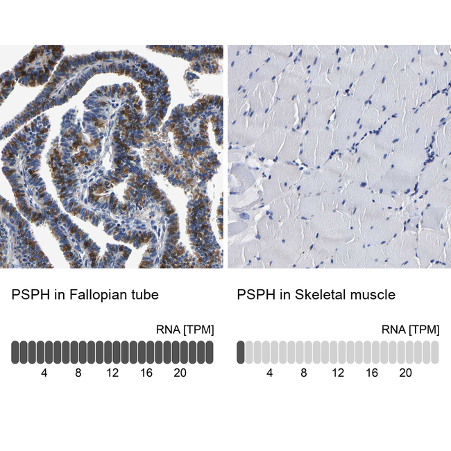 PSPH Antibody in Immunohistochemistry (Paraffin) (IHC (P))