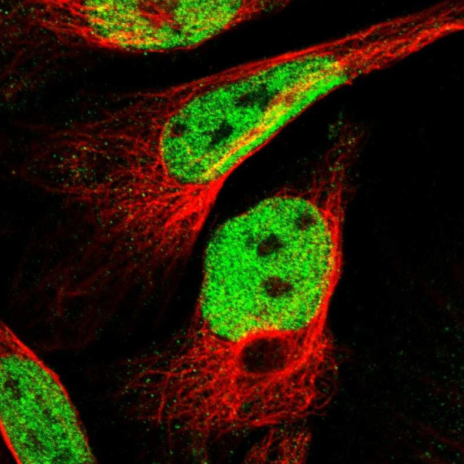 INIP Antibody in Immunocytochemistry (ICC/IF)