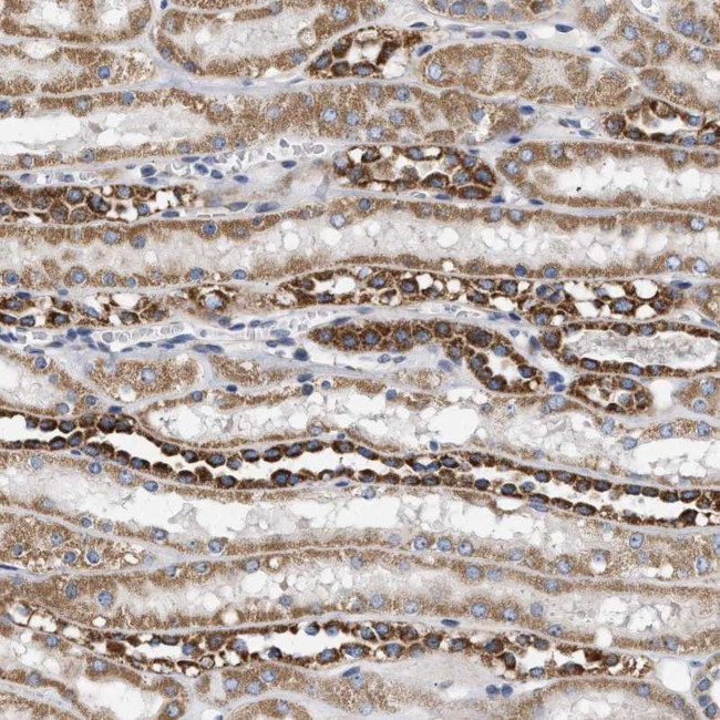 TMEM168 Antibody in Immunohistochemistry (Paraffin) (IHC (P))