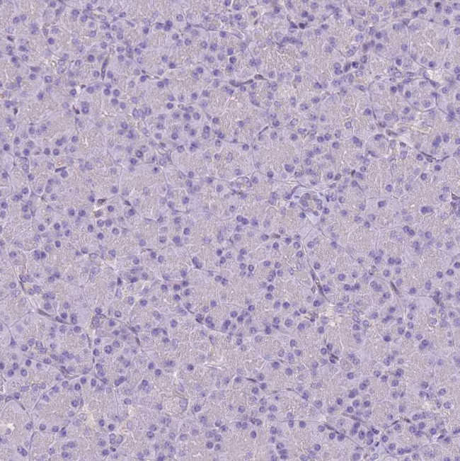 Calpain 9 Antibody in Immunohistochemistry (Paraffin) (IHC (P))