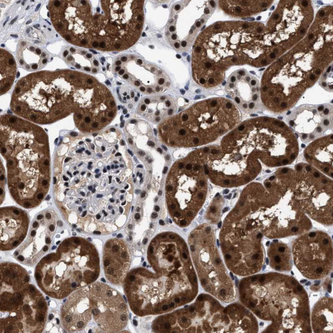 CAAP1 Antibody in Immunohistochemistry (Paraffin) (IHC (P))