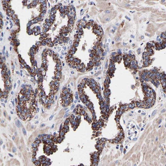 SHFM1 Antibody in Immunohistochemistry (Paraffin) (IHC (P))