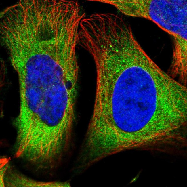 DARS Antibody in Immunocytochemistry (ICC/IF)
