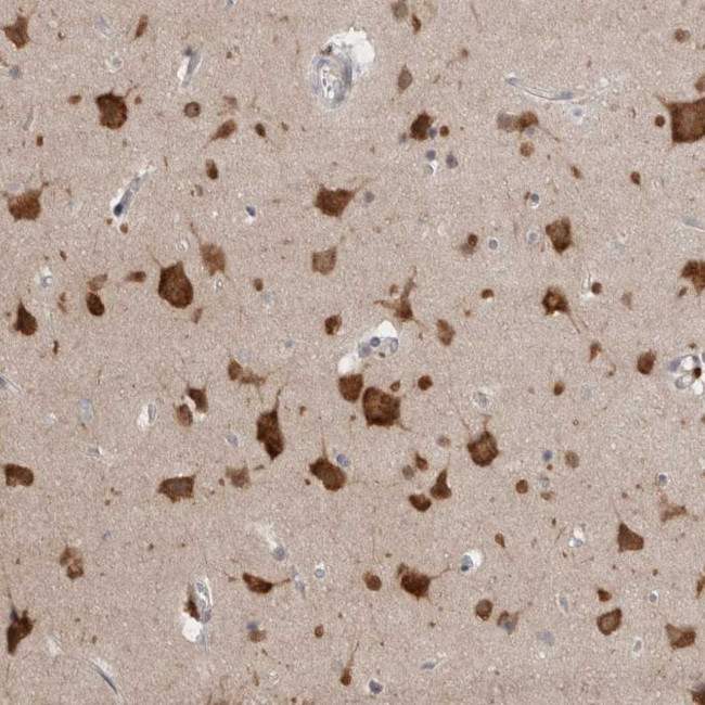 RASAL2 Antibody in Immunohistochemistry (Paraffin) (IHC (P))