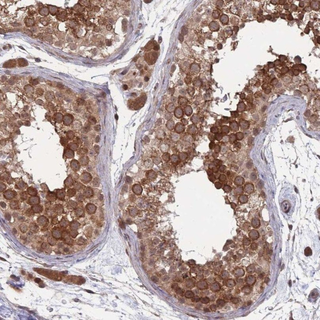 CNTRL Antibody in Immunohistochemistry (IHC)