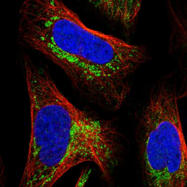 MALSU1 Antibody in Immunocytochemistry (ICC/IF)