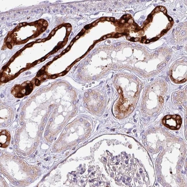 SCIN Antibody in Immunohistochemistry (Paraffin) (IHC (P))