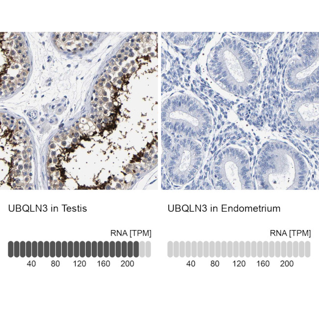 Ubiquilin 3 Antibody in Immunohistochemistry (IHC)