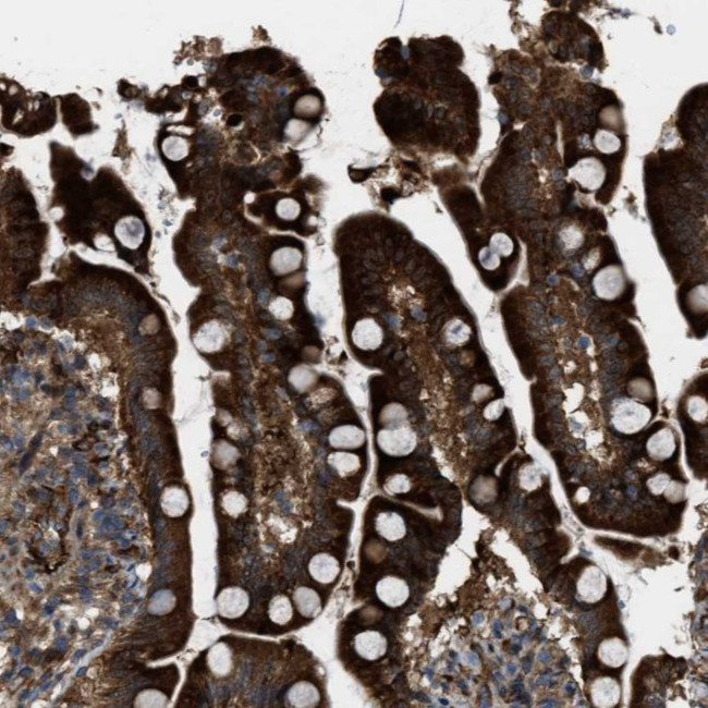 LRRC72 Antibody in Immunohistochemistry (Paraffin) (IHC (P))