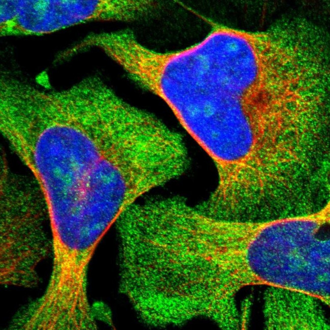 ZCCHC7 Antibody in Immunocytochemistry (ICC/IF)