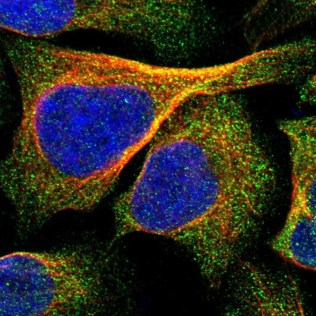 IPPK Antibody in Immunocytochemistry (ICC/IF)