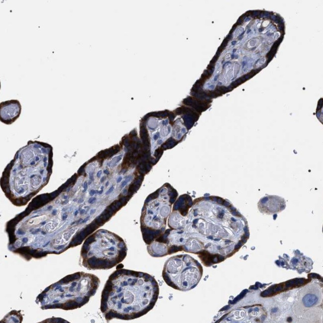 SVEP1 Antibody in Immunohistochemistry (Paraffin) (IHC (P))