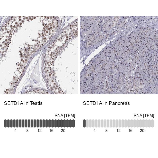 SETD1A Antibody