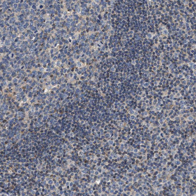 TEX2 Antibody in Immunohistochemistry (Paraffin) (IHC (P))