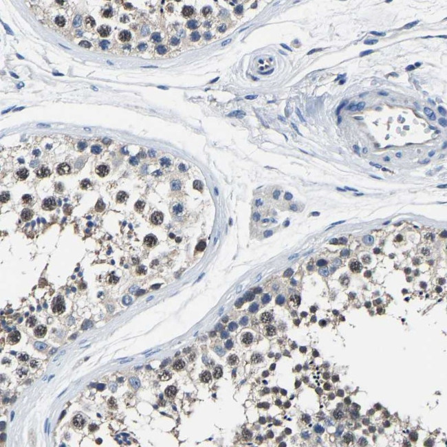 STRBP Antibody in Immunohistochemistry (Paraffin) (IHC (P))
