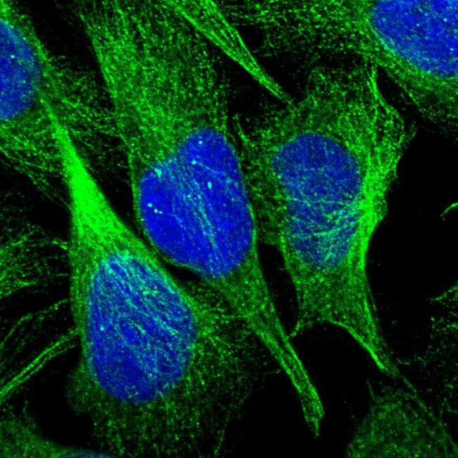 CI016 Antibody in Immunocytochemistry (ICC/IF)