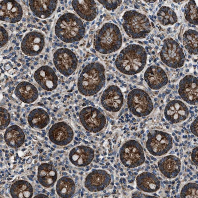 GGCT Antibody in Immunohistochemistry (Paraffin) (IHC (P))